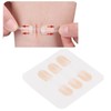 3 Strap Zipper Wound Closure Patches Breathable Seamless Elastic Zip