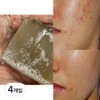 Nature Recipe Deep Cleansing Demodex Soap Demodex Soap Youth Seborrheic Skin Handmade Soap, 100g, 4 Pieces / 네이처레시피 딥클렌징 모낭충 비누 모냥염 비누 청소년 지루성 피부 수제비누, 100g, 4개입