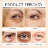 Ki Crema Reparadora De Ojos Con Péptidos 5d