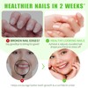 STOP Nail Biting Treatment for Kids Adults, Quick-Dry, 15ml Anti-Bite