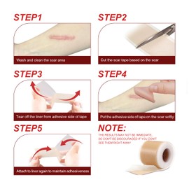 Tearich Silicone Scar Sheets (1.6”x 60” Roll-1.5M), Medical Grade Silicone Scar Tape Roll, Reusable Silicone Scar Strip, Professional Scar Removal Sheets for Surgery, C-Section, Burn, Keloid, Acne Etc
