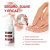 15ml Líquido Para Hongos En Las Uñas-mata Los Hongos En