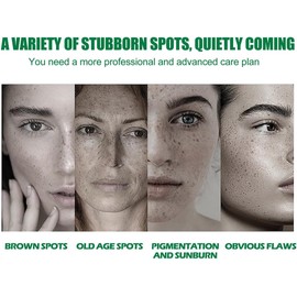 Suero Facial con Nicotinamida, Corrector de Manchas Oscuras, Elimina Pecas y Acné, Mejora la Melanina, Brillo para Rostro Opaco (2 PCS)