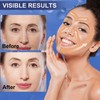 Anti Wrinkle Face Tape | Skin Tape for Wrinkles |