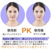 Isyou Small Face Belt, Face Belt, Small Face, V-Line, Small