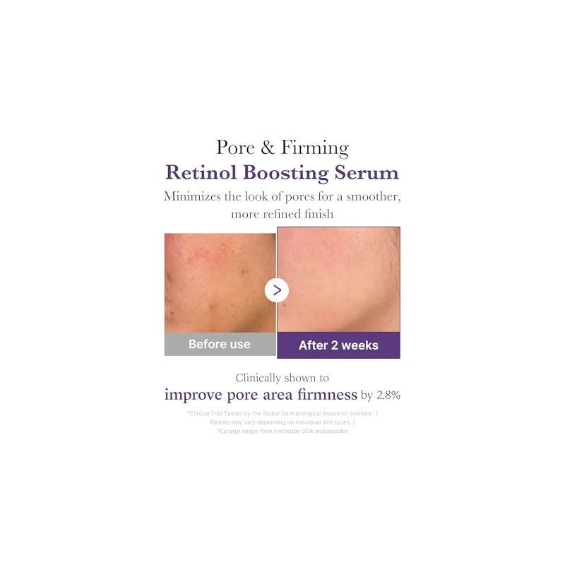RETINOL NMN BOOSTING SERUM 30ml