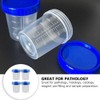 Mipcase Specimen Cups With Lids - 25pcs 120ml Urine Cups