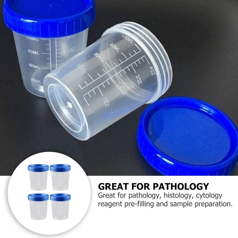 Mipcase Specimen Cups With Lids - 25pcs 120ml Urine Cups