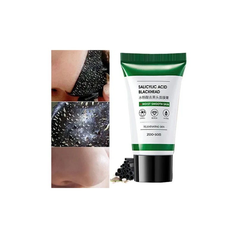 Set 3 pasos antiacné: sérum, crema y mascarilla con ácido