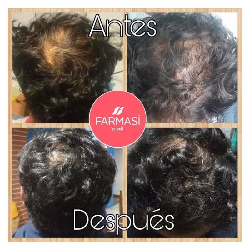 Farmasi Tratamiento Completo Caída De Cabello Reviving Dr. C Tuna