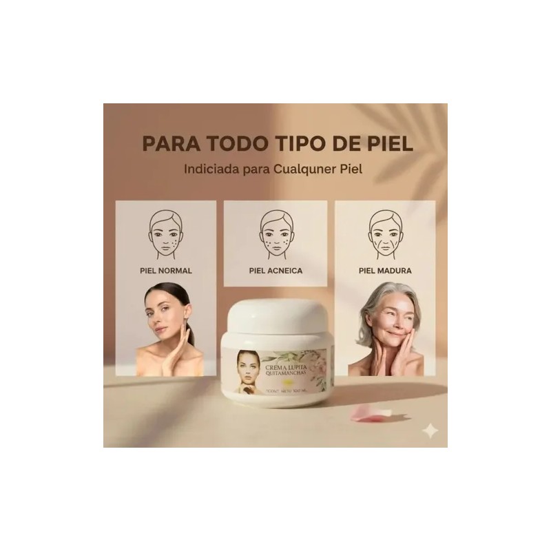 Crema Lupita Original 50ml Anti Manchas Acne Facial Axila Ca