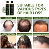 Champú Orgánico Crecimiento Cabello Romero Mujeres Hombres Natural Fortalecer Espesar