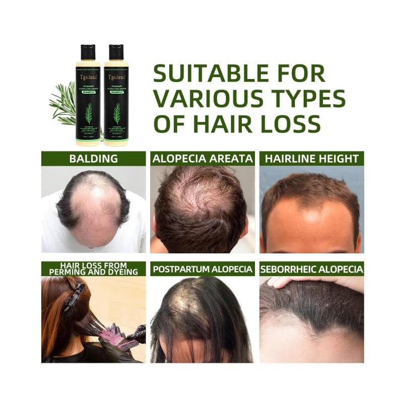 Champú Orgánico Crecimiento Cabello Romero Mujeres Hombres Natural Fortalecer Espesar