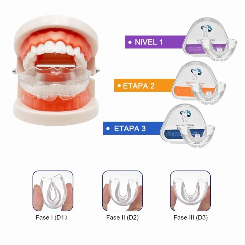 Retenedor Dientes Corrección Sonrisa