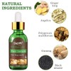 Hair Growth Serum - Treats Hair Loss & Thinning, Stimulates