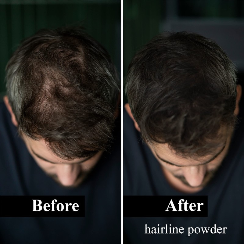 Leon Miguel® hair line powder - concealer / counter powder