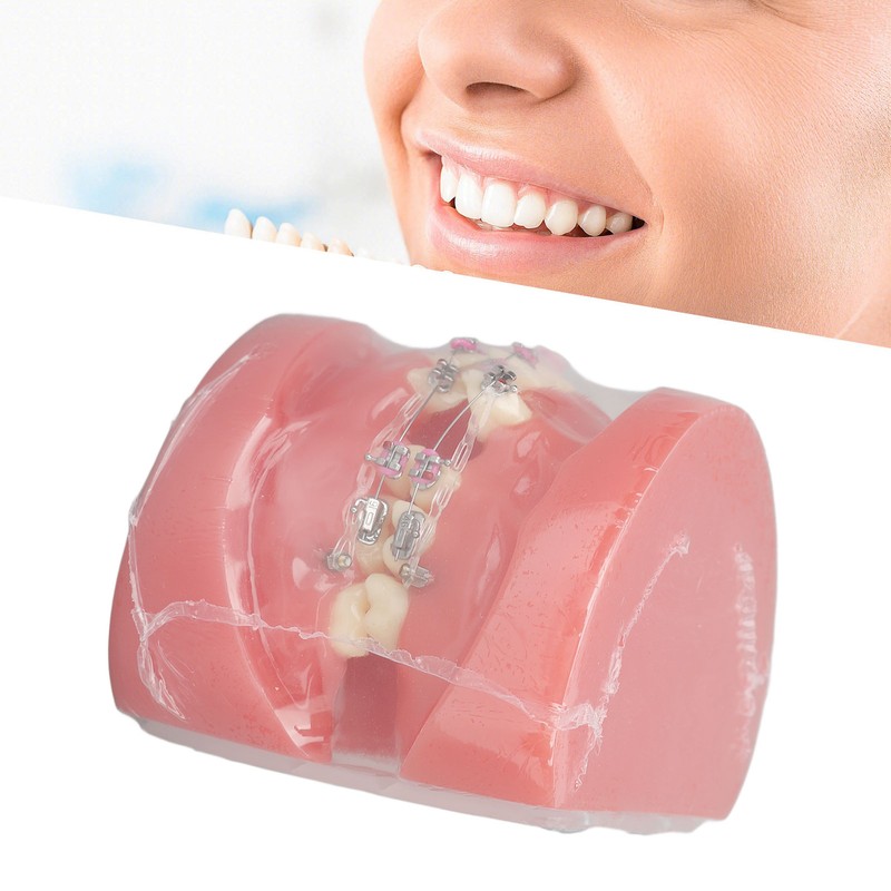 Demonstration Orthodontics Dental Model Disassembled Resin Teeth Model for Teaching