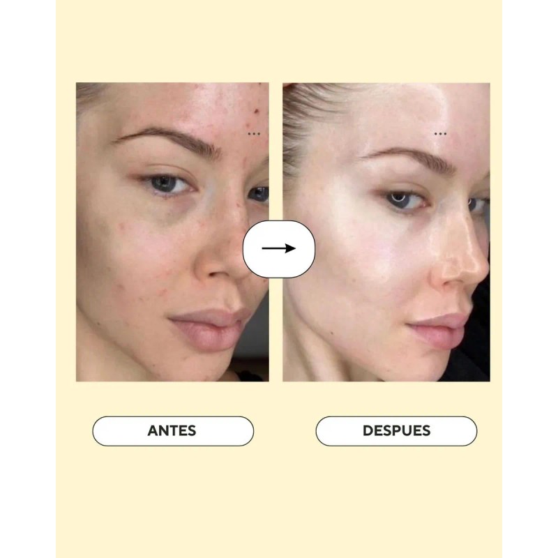 Serum Jale Real + Acido Hialuronico Todo Tipo De Piel