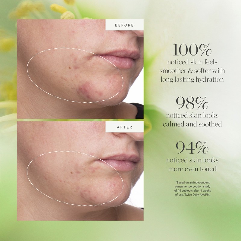 KORA Organics Active Algae Lightweight Moisturiser - 50ml