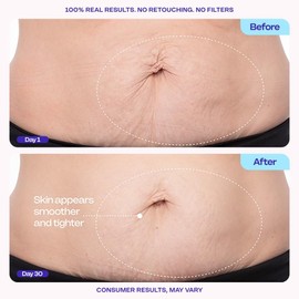 Firming Belly Cream – Body Moisturizer for Cellulite & Stretch Mark Reduction, Tightening & Smoothing, 4.25oz