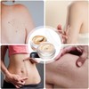 Waterproof Tattoo Cover Up Makeup with Bruises, Full Coverage, and