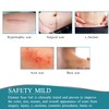 Medical Grade Silicone Scar Sheets, Silicone Scar Tape (1.6”x 60”),