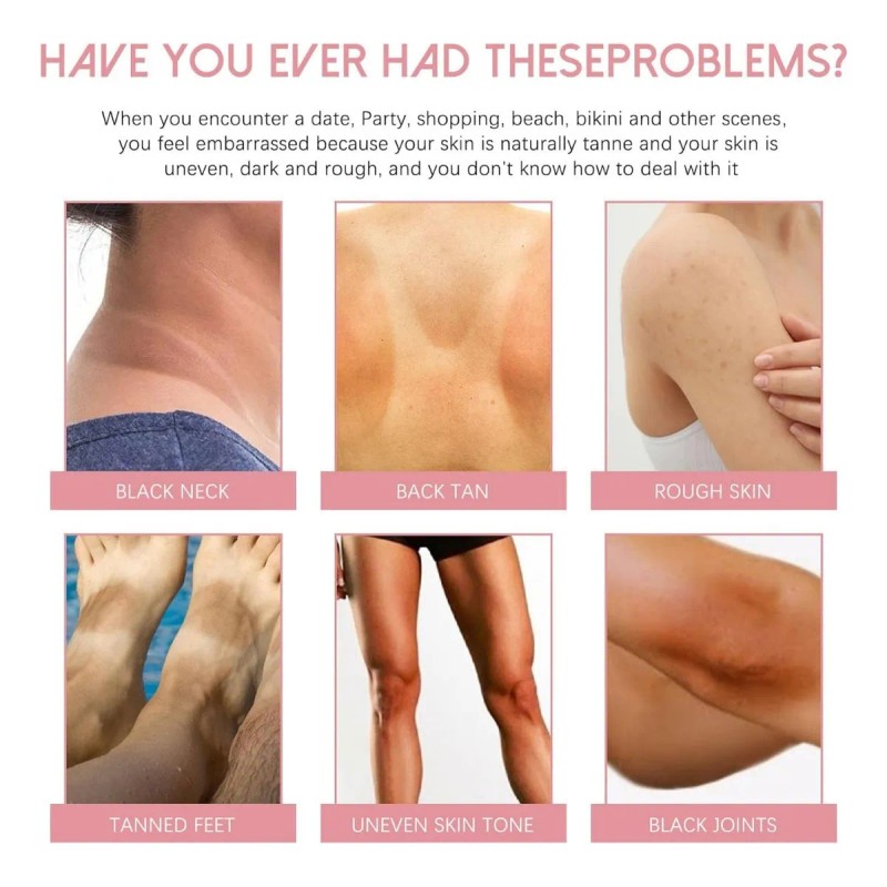 Crema Para Manchas Oscuras Del Rostro (50 Ml)