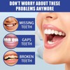 30ML Temporary Tooth Filling,Moldable False Teeth for Fixing,Temporary Tooth Repair