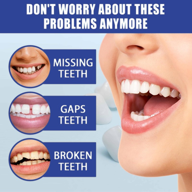 30ML Temporary Tooth Filling,Moldable False Teeth for Fixing,Temporary Tooth Repair