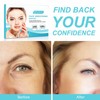 Facial Wrinkle Smoothing Patches, Anti Wrinkle Face Strips, Set of