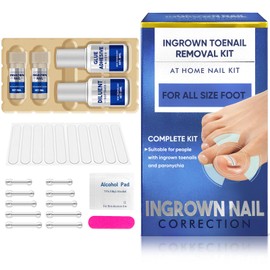 Ingrown Toenail Treatment, Home Ingrown Toenail Removal Kit, High Tensile Memory Alloy for Ingrown Toe Nail Repair, Waterproof Corrector, Easy to Use, 10 Pcs