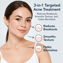 Acid 12% Acne Cream - Acne Treatment Spot Cream, Pore Clearing & Hydrating Face Lotion for Breakouts and Clogged Pores, Moisturizes Skin, Suitable for All Skin Types 20g