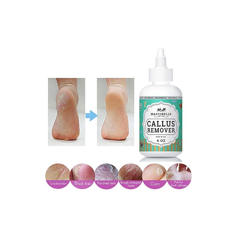 Maccibelle Callus Remover EXTRA STRENGTH For Feet, Professional Callus and