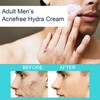 Gesichtspflege Creme, Anti-Pickel Gesichtspflege für Männer, Beruhigende Gesichtscreme für Männer,