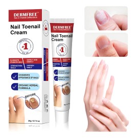 Crema Fúngica Para Uñas,eliminación Hongo De La Uña 20g