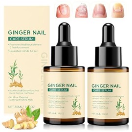 Ginger Nail, 2pzs Suero de Jengibre 30ml para Crecimiento y Fortalecimiento de Uñas, Extracto de Jengibre y Cúrcuma, Hidrata y Repara Uñas Agrietadas,