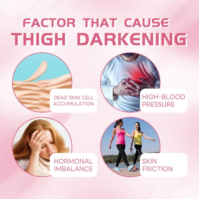 Leg Makeup Cream, Make-up Cover Cream (03, Normal)