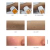 The Lapo Rapomedic Ice Plant Bladder Gel 300ml / 더라포