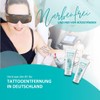 ENDLICH OHNE Tattooentfernung - Care/Aftercare for Laser-Treated Skin - Laser