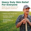 Corn Huskers Oil-Free Hand Lotion -- 7 fl oz (Pack