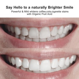 Nobaton 1% Fruit Acid Whitening Ampoule Toothpaste with Nano hap, Gentle Enamel-Safe Brightening, Removes Stains from Coffee/Tea/Smoking, Strengthens & Protects Teeth, 3 Bottles(1.23 oz Each)