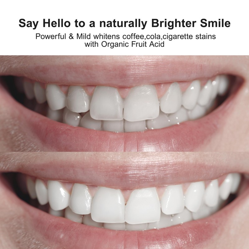 Nobaton 1% Fruit Acid Whitening Ampoule Toothpaste with Nano hap,