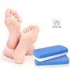 Glass Pumice Stone for Feet – Callus Remover for Soft,