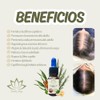 Aceite Capilar Ozonizado Romero Anti-caida De Cabello (10 ML)