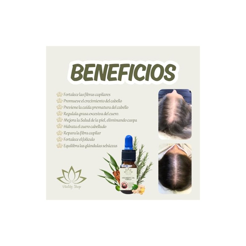 Aceite Capilar Ozonizado Romero Anti-caida De Cabello (10 ML)