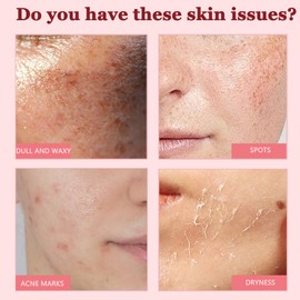 Skin Refining Serum with Niacinamide, helps to improve uneven skin tone, giving the skin a more even and radiant appearance, in a 30ml size