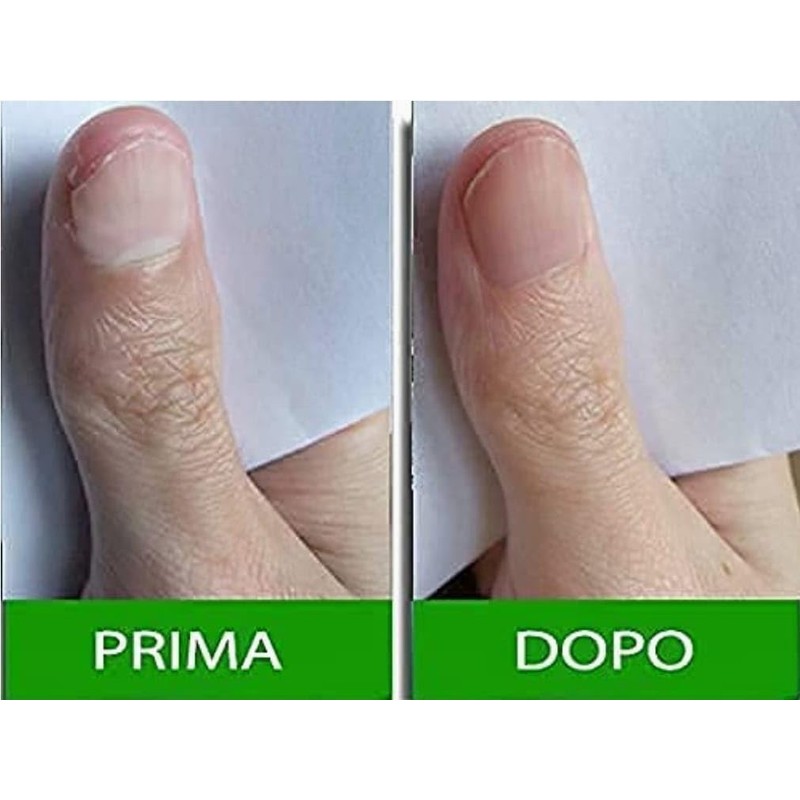Pantogar (Pantovigar) Specific Treatment for Hair and Nails - 90
