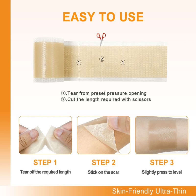 Carbou Silicone Scar Sheets (1.6"x 60"Roll) Medical Silicone Scar Tape