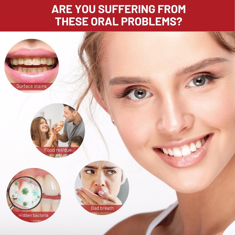 2pcs SP 10 Probiotic Toothpaste Whitening – Improve Oral Health