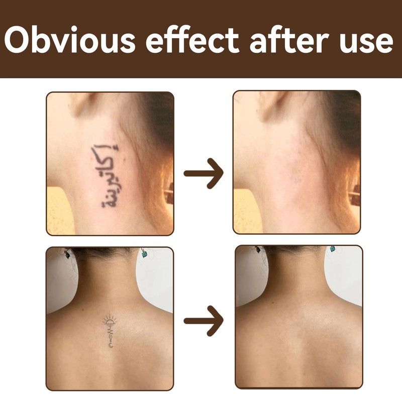 Tattoo Concealer for Body, Waterproof Long Lasting Body Concealer Primer
